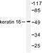 Keratin 16 antibody, LS-C176093, Lifespan Biosciences, Western Blot image 