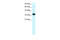 TIA1 Cytotoxic Granule Associated RNA Binding Protein Like 1 antibody, 31-020, ProSci, Western Blot image 