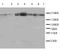 DCC Netrin 1 Receptor antibody, LS-C313044, Lifespan Biosciences, Western Blot image 