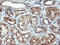 Calcium Modulating Ligand antibody, M08322, Boster Biological Technology, Immunohistochemistry paraffin image 