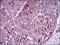 Melanoma Cell Adhesion Molecule antibody, GTX60775, GeneTex, Immunohistochemistry paraffin image 