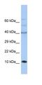 UFM1 Specific Peptidase 1 (Inactive) antibody, orb325918, Biorbyt, Western Blot image 