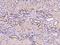 Transmembrane 4 L Six Family Member 1 antibody, 204803-T08, Sino Biological, Immunohistochemistry paraffin image 