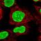 Poly(ADP-Ribose) Polymerase 1 antibody, NBP2-13732, Novus Biologicals, Immunofluorescence image 