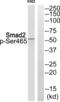 SMAD2 antibody, PA5-37634, Invitrogen Antibodies, Western Blot image 