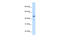 Fibrinogen Gamma Chain antibody, 29-981, ProSci, Western Blot image 