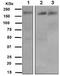 Insulin Receptor Substrate 2 antibody, ab134101, Abcam, Western Blot image 