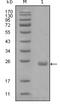AXL Receptor Tyrosine Kinase antibody, NBP1-47351, Novus Biologicals, Western Blot image 