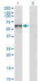 Unc-5 Family C-Terminal Like antibody, MA5-23197, Invitrogen Antibodies, Western Blot image 