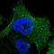 SRP Receptor Subunit Beta antibody, NBP1-89035, Novus Biologicals, Immunofluorescence image 