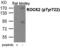 Rho Associated Coiled-Coil Containing Protein Kinase 2 antibody, PA5-37774, Invitrogen Antibodies, Western Blot image 
