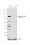 Androgen Receptor antibody, MA5-15598, Invitrogen Antibodies, Western Blot image 