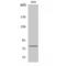 Nuclear Cap Binding Protein Subunit 1 antibody, LS-C382487, Lifespan Biosciences, Western Blot image 