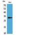 CD37 Molecule antibody, STJ96827, St John