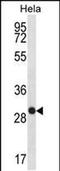 WAP Four-Disulfide Core Domain 1 antibody, PA5-48379, Invitrogen Antibodies, Western Blot image 