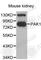 P21 (RAC1) Activated Kinase 1 antibody, A3279, ABclonal Technology, Western Blot image 