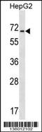 Amiloride-sensitive cation channel 4 antibody, 58-541, ProSci, Western Blot image 