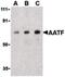 Apoptosis Antagonizing Transcription Factor antibody, PA5-20006, Invitrogen Antibodies, Western Blot image 