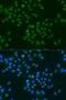 Cold Inducible RNA Binding Protein antibody, LS-C746847, Lifespan Biosciences, Immunofluorescence image 