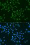 CIRBP antibody, LS-C746847, Lifespan Biosciences, Immunofluorescence image 