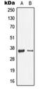 Chaperonin Containing TCP1 Subunit 4 antibody, orb341110, Biorbyt, Western Blot image 