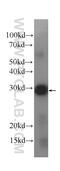 Interleukin-12 subunit alpha antibody, 60324-1-Ig, Proteintech Group, Western Blot image 