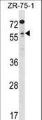 Transcription Factor Like 5 antibody, LS-C161774, Lifespan Biosciences, Western Blot image 