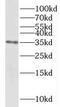 NADH:Ubiquinone Oxidoreductase Complex Assembly Factor 1 antibody, FNab05614, FineTest, Western Blot image 