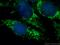 B-Raf Proto-Oncogene, Serine/Threonine Kinase antibody, 20899-1-AP, Proteintech Group, Immunofluorescence image 