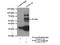 Patatin-like phospholipase domain-containing protein 3 antibody, 11442-1-AP, Proteintech Group, Immunoprecipitation image 