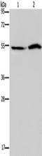Urat1 antibody, TA351468, Origene, Western Blot image 