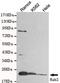 RAB2A, Member RAS Oncogene Family antibody, MA5-24761, Invitrogen Antibodies, Western Blot image 