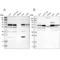Phosphatidylinositol Binding Clathrin Assembly Protein antibody, NBP1-86659, Novus Biologicals, Western Blot image 