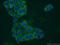 Glycogen Phosphorylase L antibody, 55429-1-AP, Proteintech Group, Immunofluorescence image 
