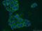 Glycogen phosphorylase, liver form antibody, 55429-1-AP, Proteintech Group, Immunofluorescence image 