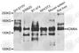 Lysine-specific demethylase 6A antibody, A8159, ABclonal Technology, Western Blot image 