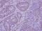 Histone Deacetylase 7 antibody, NBP2-16795, Novus Biologicals, Immunohistochemistry paraffin image 