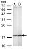 NFKB Inhibitor Interacting Ras Like 2 antibody, NBP1-31696, Novus Biologicals, Western Blot image 
