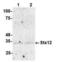 Syntaxin 12 antibody, 54-335, ProSci, Western Blot image 