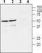 GDNF Family Receptor Alpha 4 antibody, PA5-77540, Invitrogen Antibodies, Western Blot image 