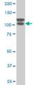 ARVCF Delta Catenin Family Member antibody, H00000421-M01, Novus Biologicals, Western Blot image 