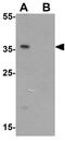 Aminoacyl TRNA Synthetase Complex Interacting Multifunctional Protein 2 antibody, GTX31896, GeneTex, Western Blot image 