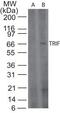 Tripartite Motif Containing 69 antibody, PA1-20824, Invitrogen Antibodies, Western Blot image 