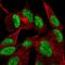 Dishevelled Segment Polarity Protein 2 antibody, NBP2-56345, Novus Biologicals, Immunocytochemistry image 