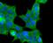 ATP Binding Cassette Subfamily C Member 2 antibody, A00974, Boster Biological Technology, Immunocytochemistry image 