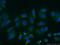 Integrin Linked Kinase antibody, 24926-1-AP, Proteintech Group, Immunofluorescence image 