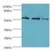 Regulator Of Microtubule Dynamics 3 antibody, MBS1497052, MyBioSource, Western Blot image 