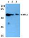 WASP Family Member 1 antibody, A02114, Boster Biological Technology, Western Blot image 