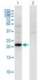 Choriogonadotropin subunit beta antibody, H00093659-M02, Novus Biologicals, Western Blot image 