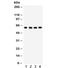 Cell Division Cycle 73 antibody, R32268, NSJ Bioreagents, Western Blot image 